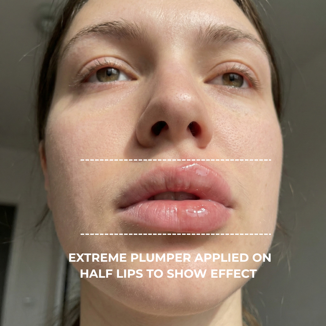 Extreme Plump Injection applied to half the lips, before and after