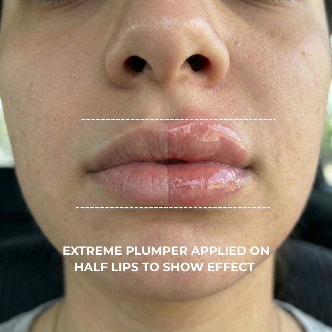 Extreme Plump Injection applied to half the lips, close-up