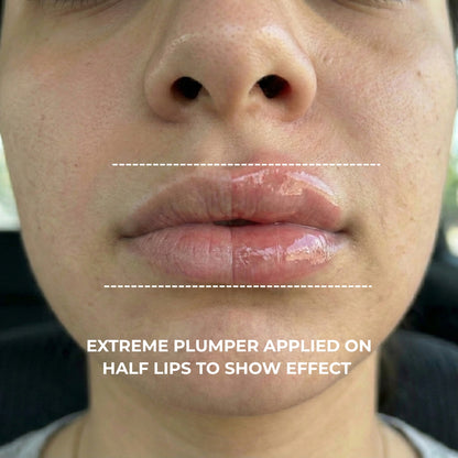 Extreme Plump Injection applied to half the lips, close-up