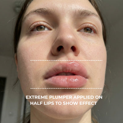 Extreme Plump Injection applied to half the lips to show the effect