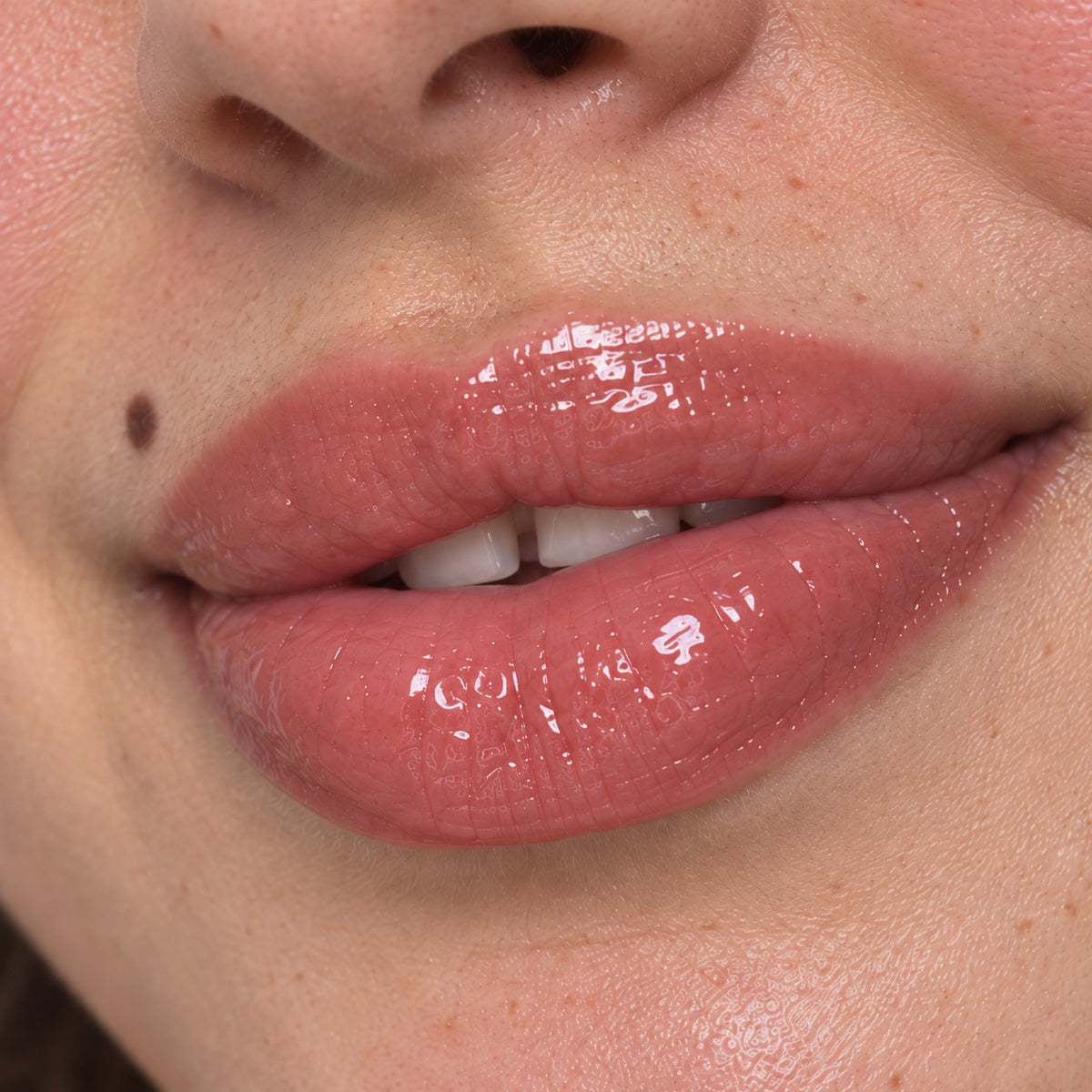 Lips